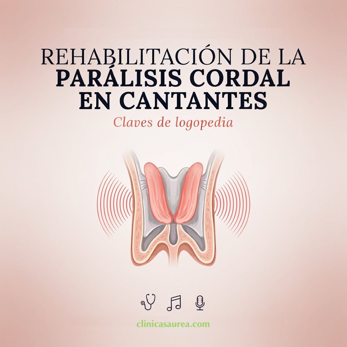 Rehabilitación de la parálisis cordal en cantantes: Claves de logopedia